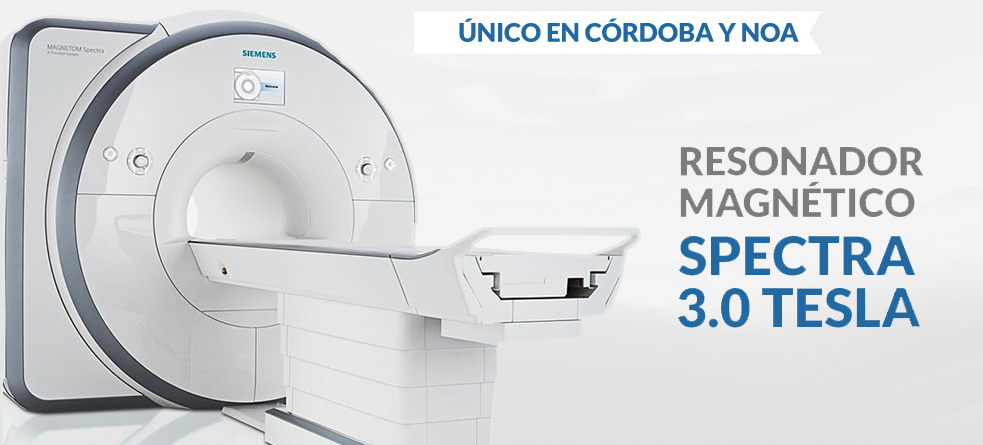 coches tesla en madrid